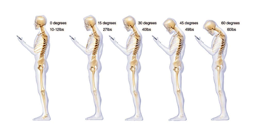 The Truth About Text Neck&nbsp;Syndrome